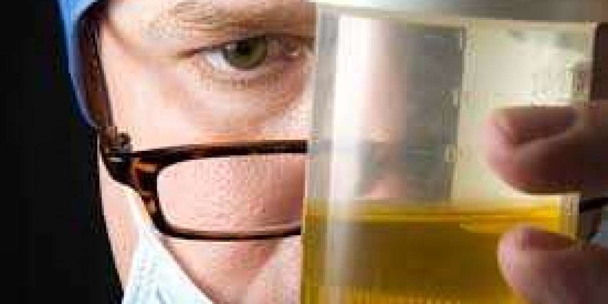 What Everyone Is Saying About Fake Urine