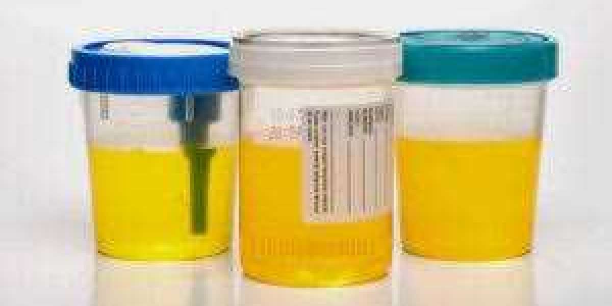 The Unexplained Mystery Into Synthetic Urine Uncovered