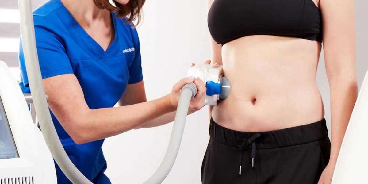 Affordable coolsculpting near me