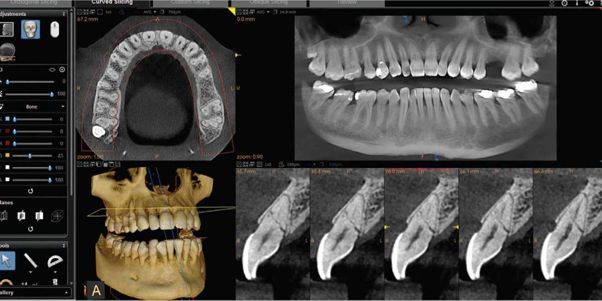 CBCT Dental Imaging Market Research- Driven by The Strategic Decision-Making Process