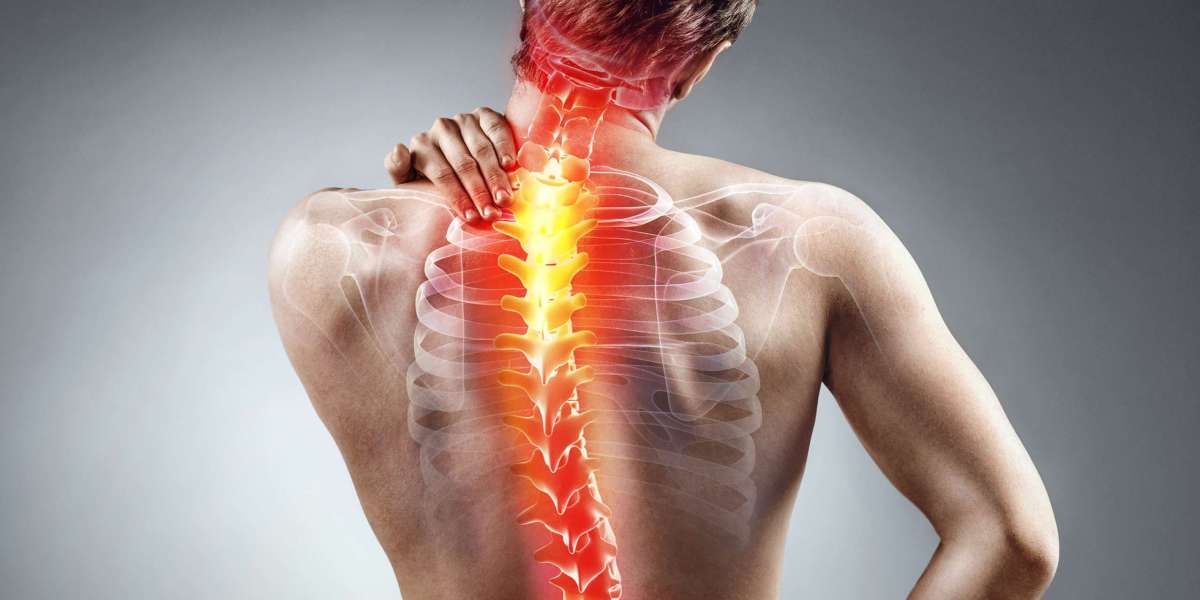 The Role of Muscle Relaxants in Chronic Low Back Pain Treatment