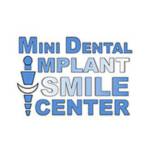 Mini Dental Implant Smile Center Smile Center