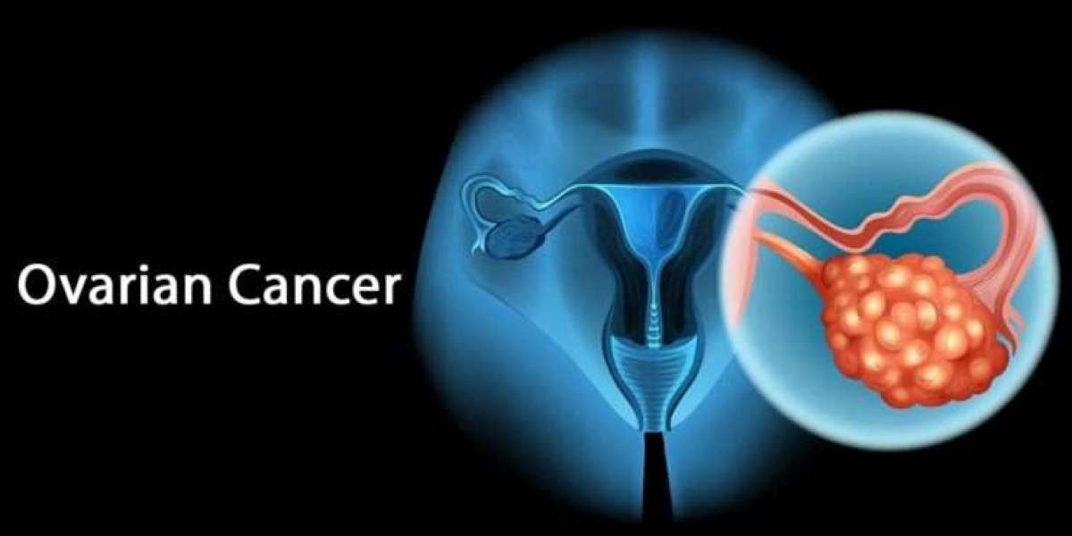 Understanding Ovarian Cancer: An Ayurvedic  Perspective