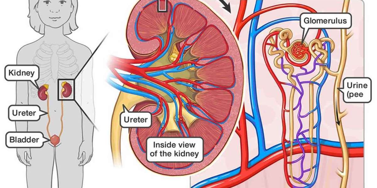 Glomerulonephritis Disease Trends and Treatment Insights