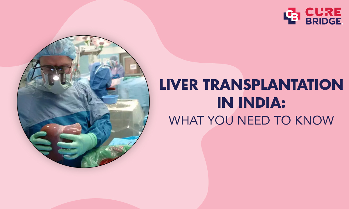 Liver Transplantation in India: What You Need to Know - Curebridge
