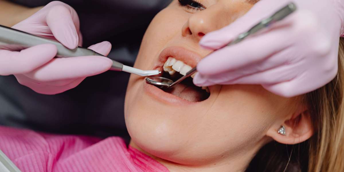 Beyond Clean Teeth: Unveiling the Vital Role of Dental Hygienists in Wanstead