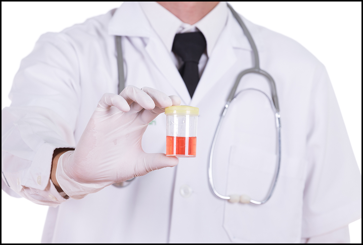 Whizolosophy | Blood in Urine: Can It Resolve Itself Naturally?