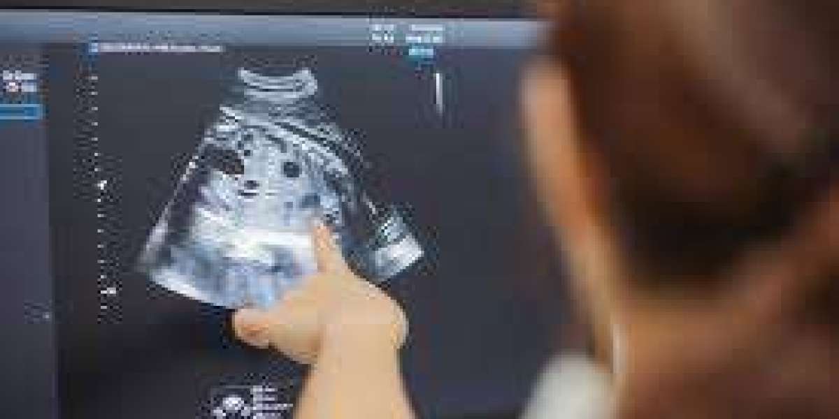 Discover Top-notch Ultrasound Solutions in Murfreesboro