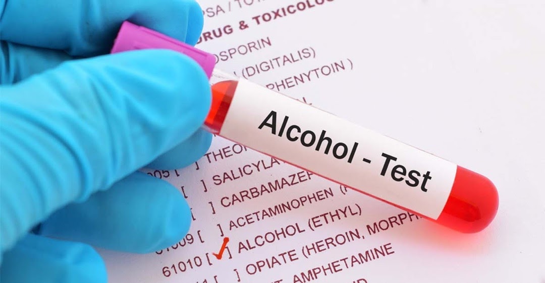 Unveiling Accuracy: Navigating Alcohol Testing in Naperville with Evance Backcheck
