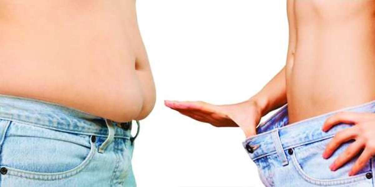 Decoding Beauty Budgets: Liposuction Costs Exposed in Dubai