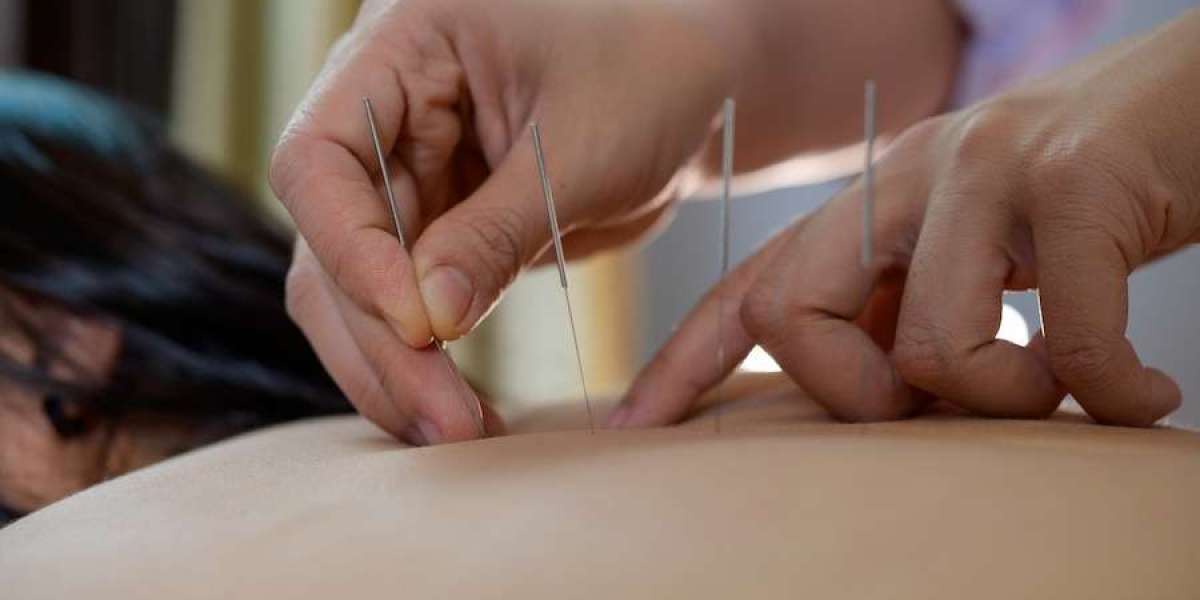Benefits Of Acupuncture In Morristown You Must
