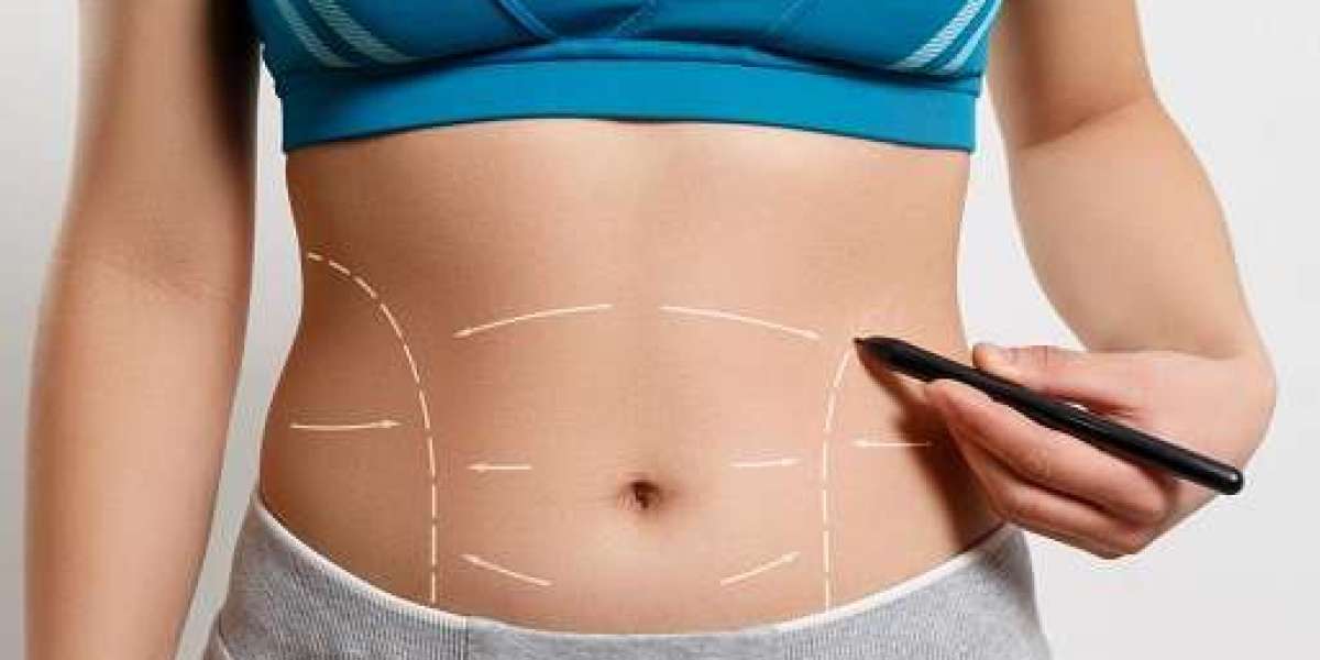Why Abdominoplasty Reigns Supreme: Insider Tips and Tricks Revealed