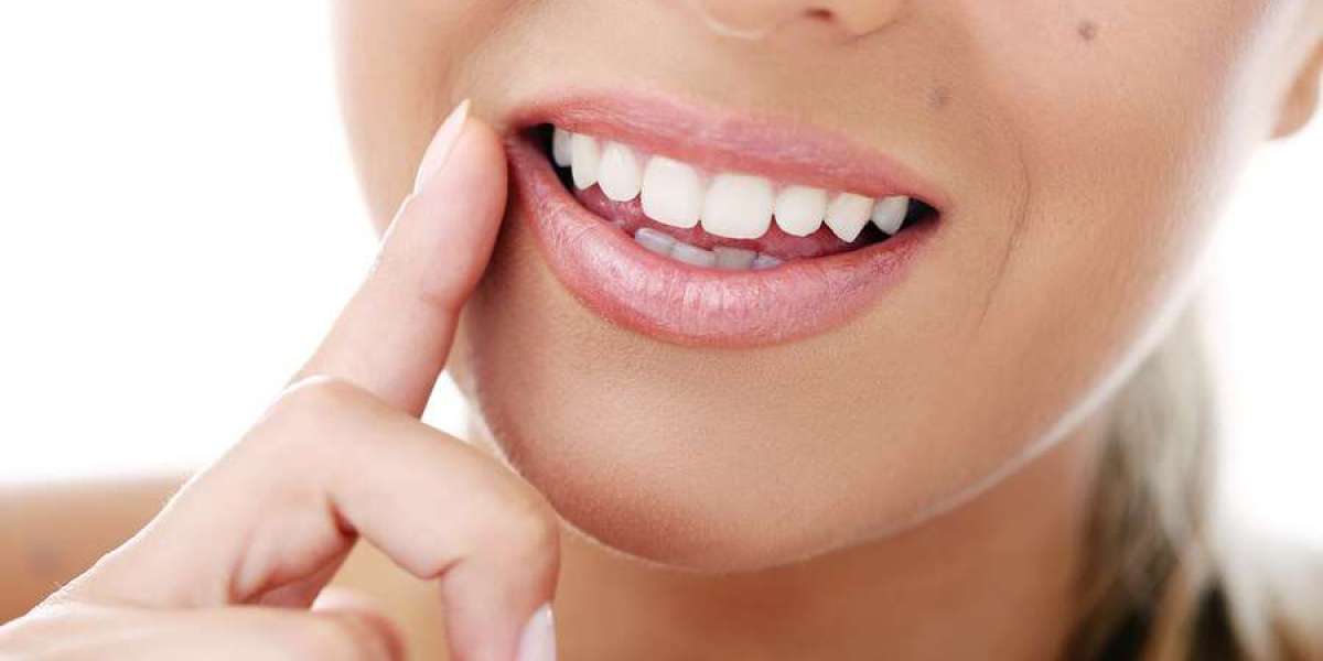 Deciding Between Teeth Whitening and Dental Veneers: Which Option is Right for You?
