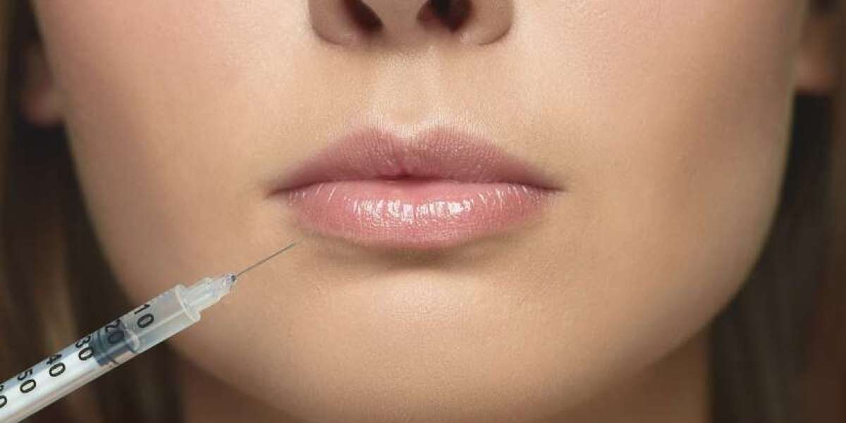 A Comprehensive Guide to Lip Injections: What You Need to Know