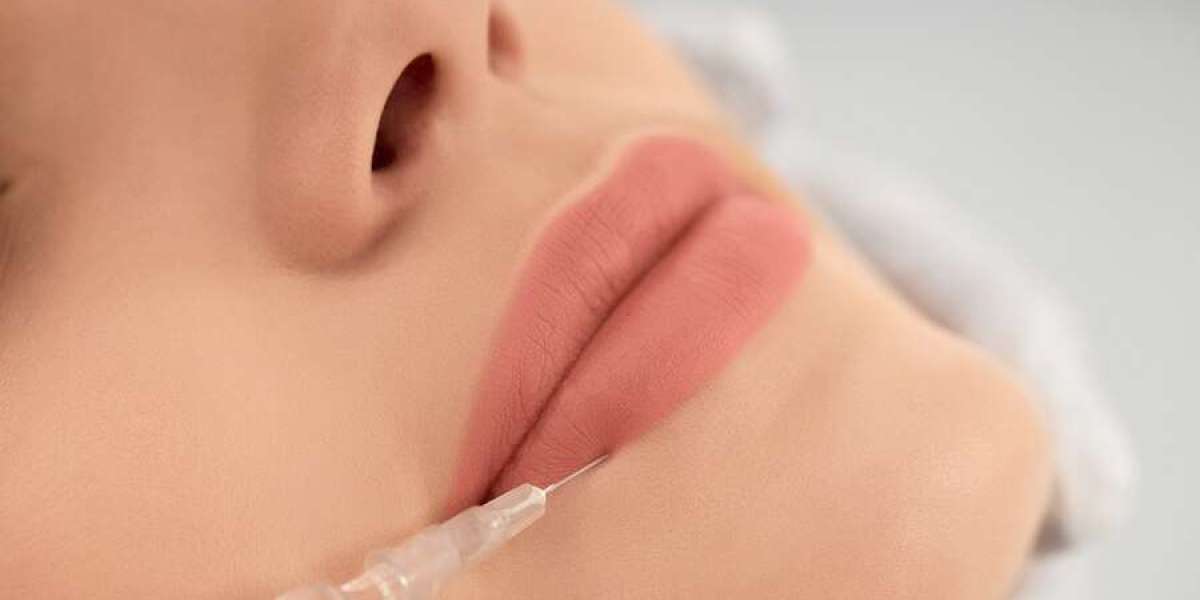 6 Major Lip Filler Benefits & What To Expect