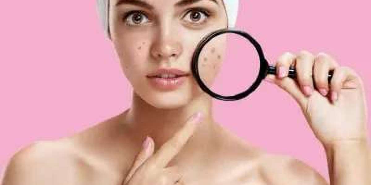 Brighter Skin Awaits: Tan Removal Services in Dubai