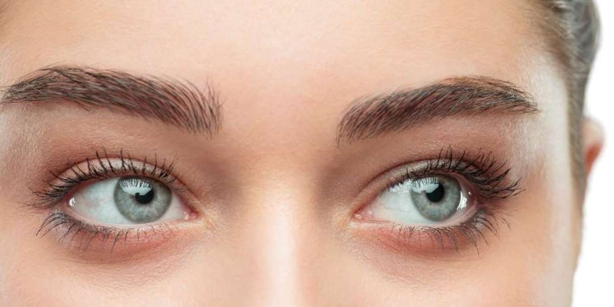Transform Your Look with a Dubai Eyebrow Hair Transplant: A Step-by-Step Guide