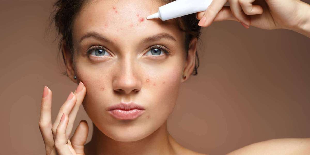 Breaking Down Different Types of Acne Treatments